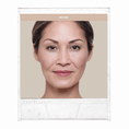 Load image into Gallery viewer, Cheek Filler/Contour (1 syringe of: Juvederm Voluma, Restylane Lyft)