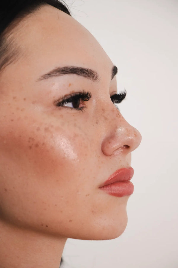 Nose Filler