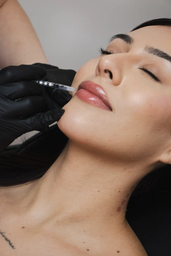 Lip Filler