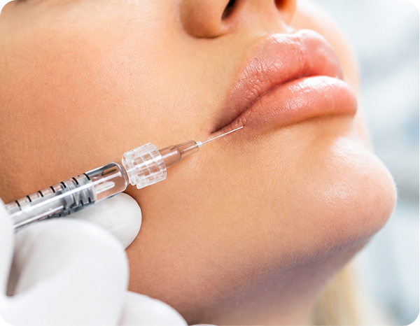 Lip Filler