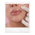 Load image into Gallery viewer, Lip Filler (your choice of: Juvederm ultra/ultra plus, Restylane Kysse, Restylane Refyne/Defyne, 1ml)