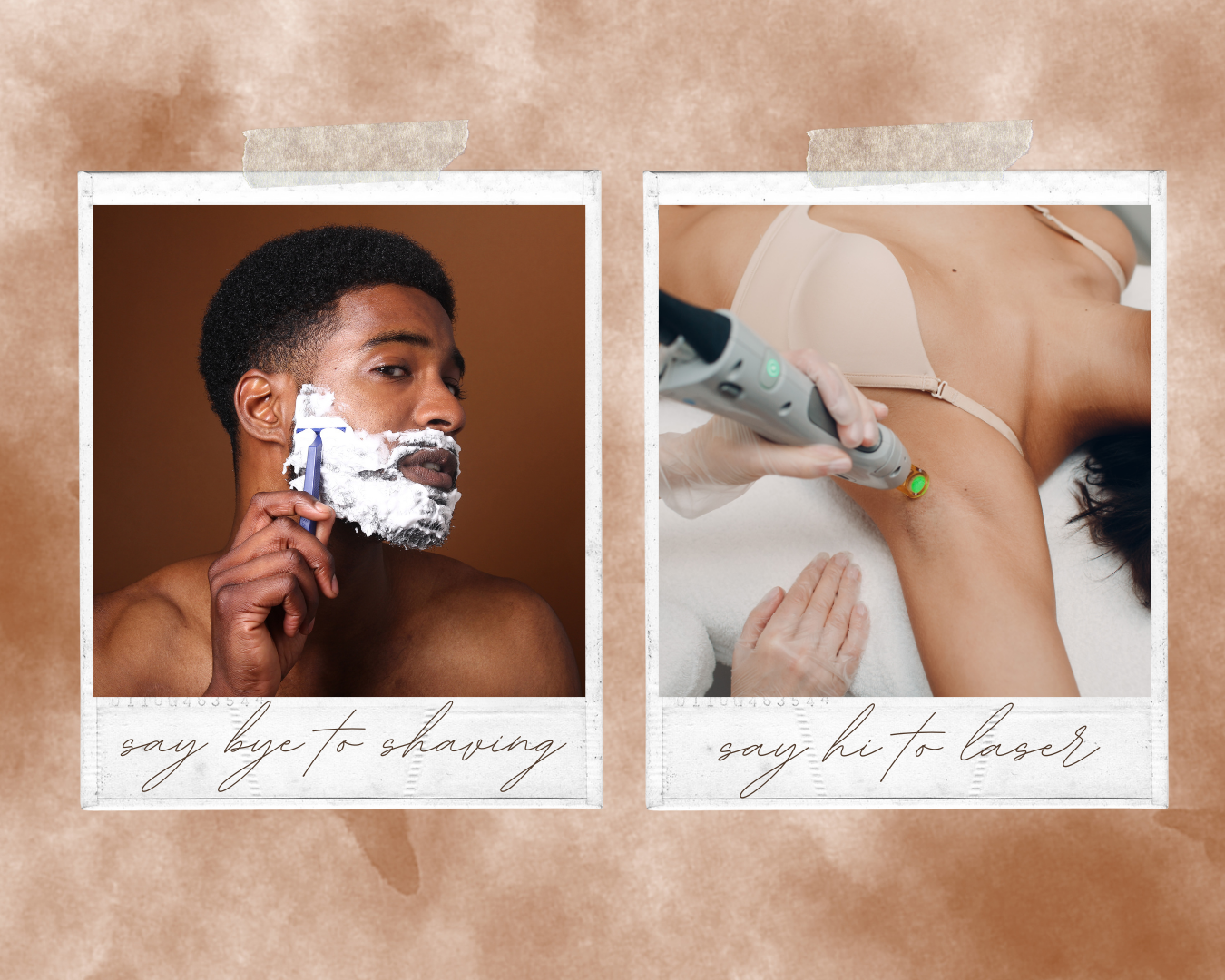 Laser Hair Removal vs Shaving: Everything You Need to Know