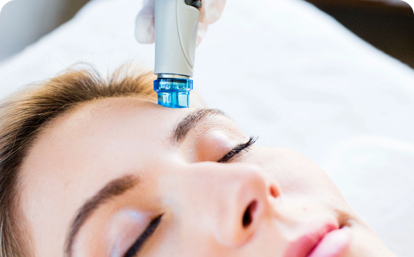 Close up of a person receiving a Hydrafacial treatment with a blue device applied to the forehead.