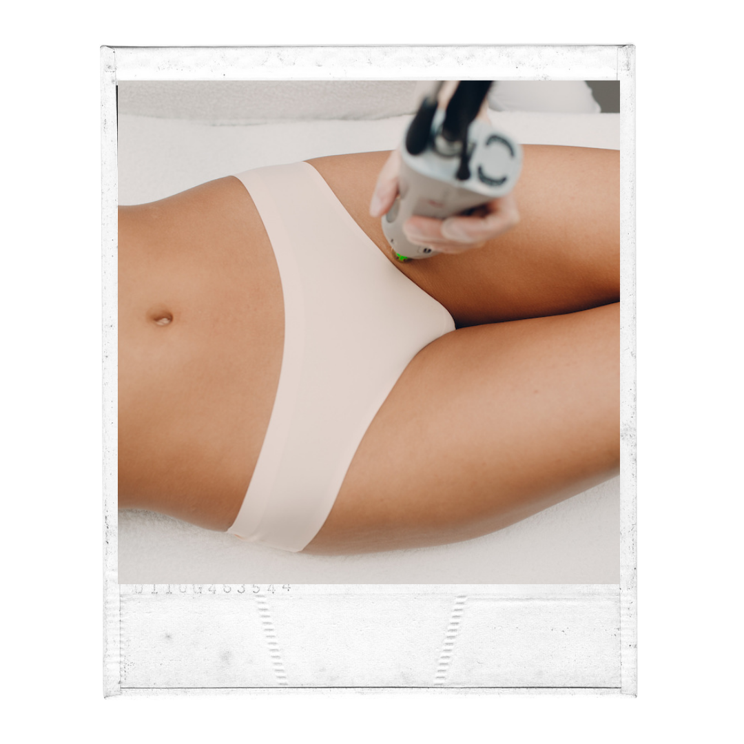 Laser Hair Removal - Women (Series of 3)