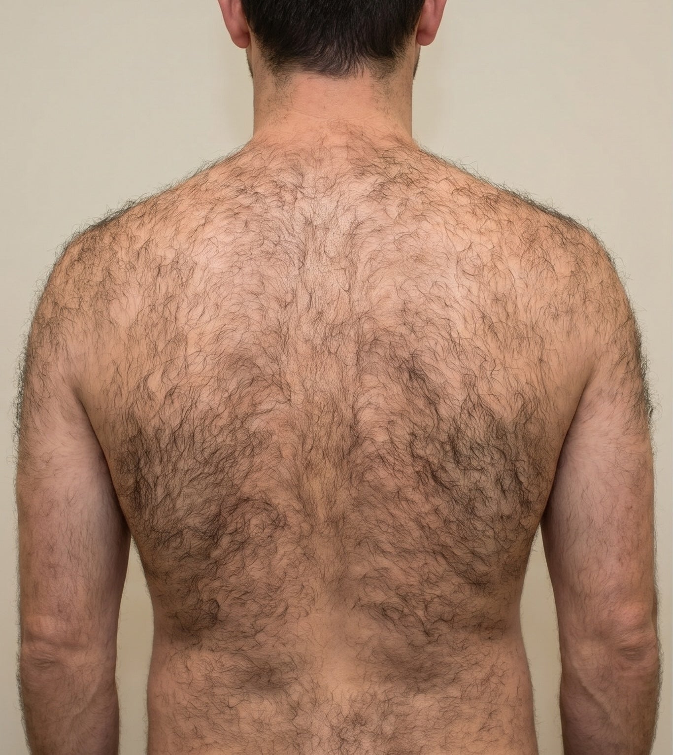 Before treatment