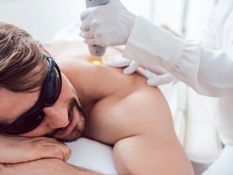 Laser hair removal.