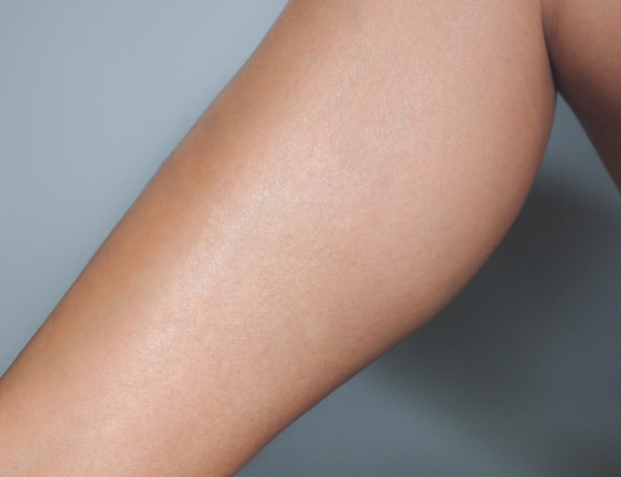 After treatment