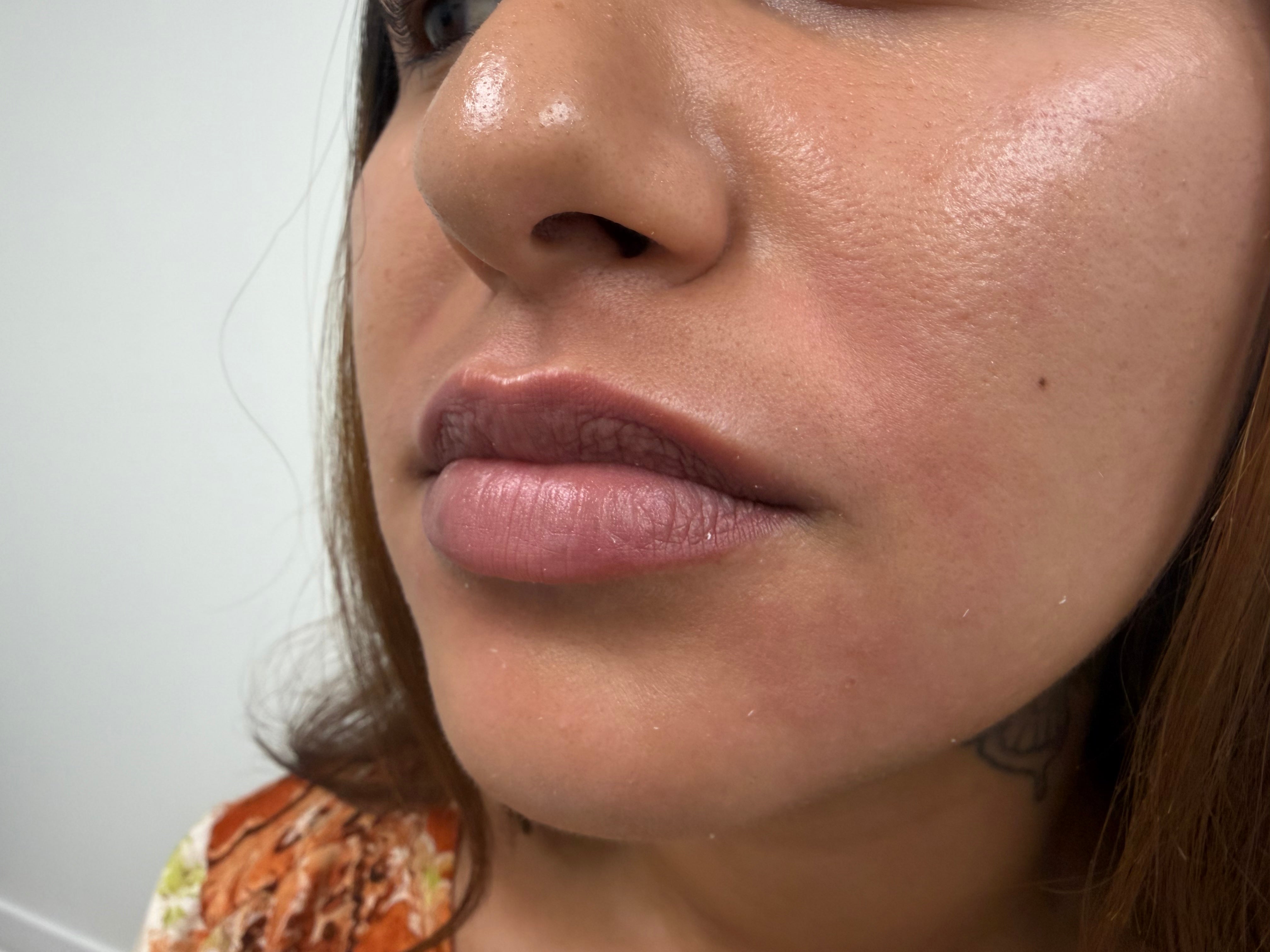 Before treatment