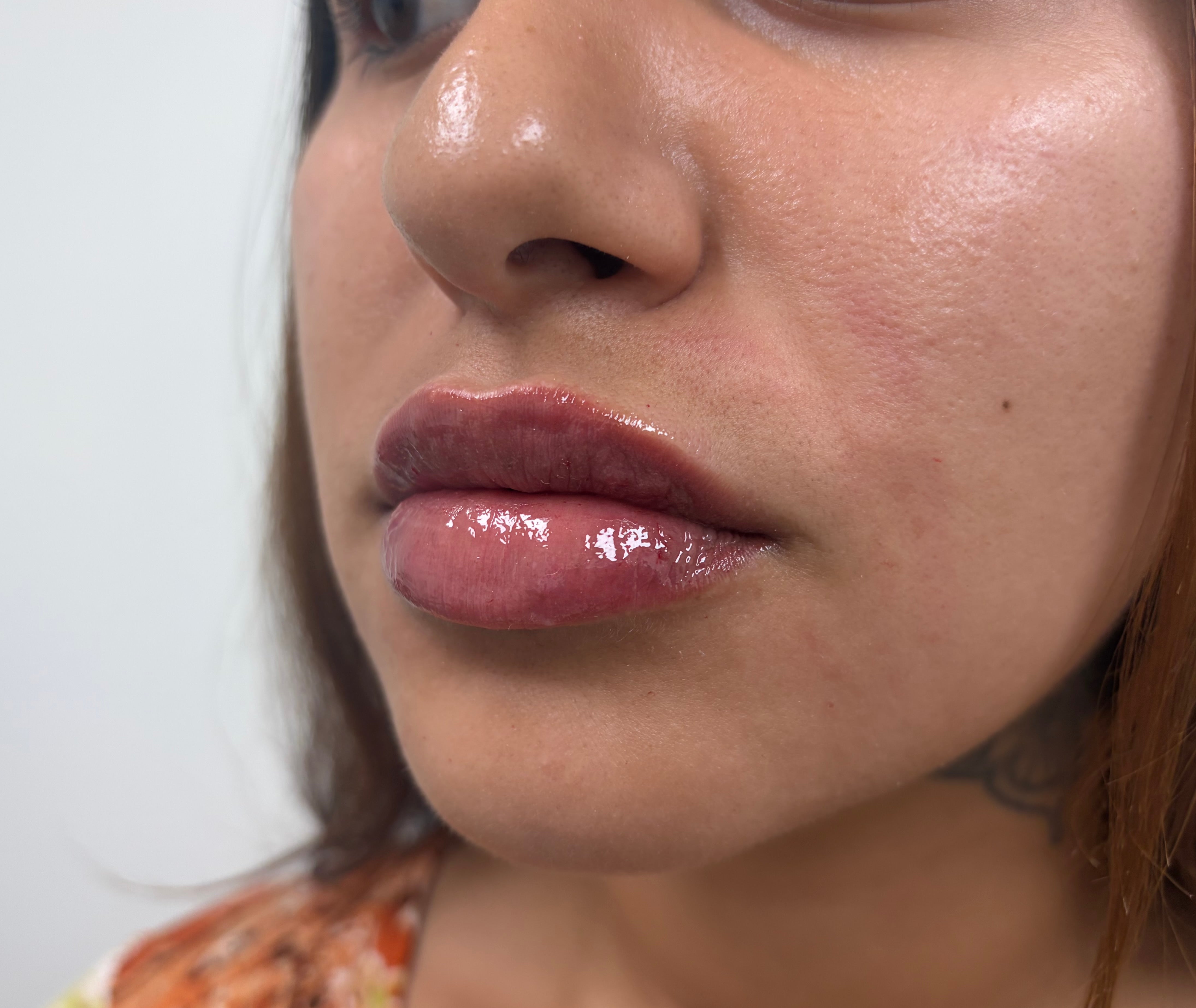 After treatment