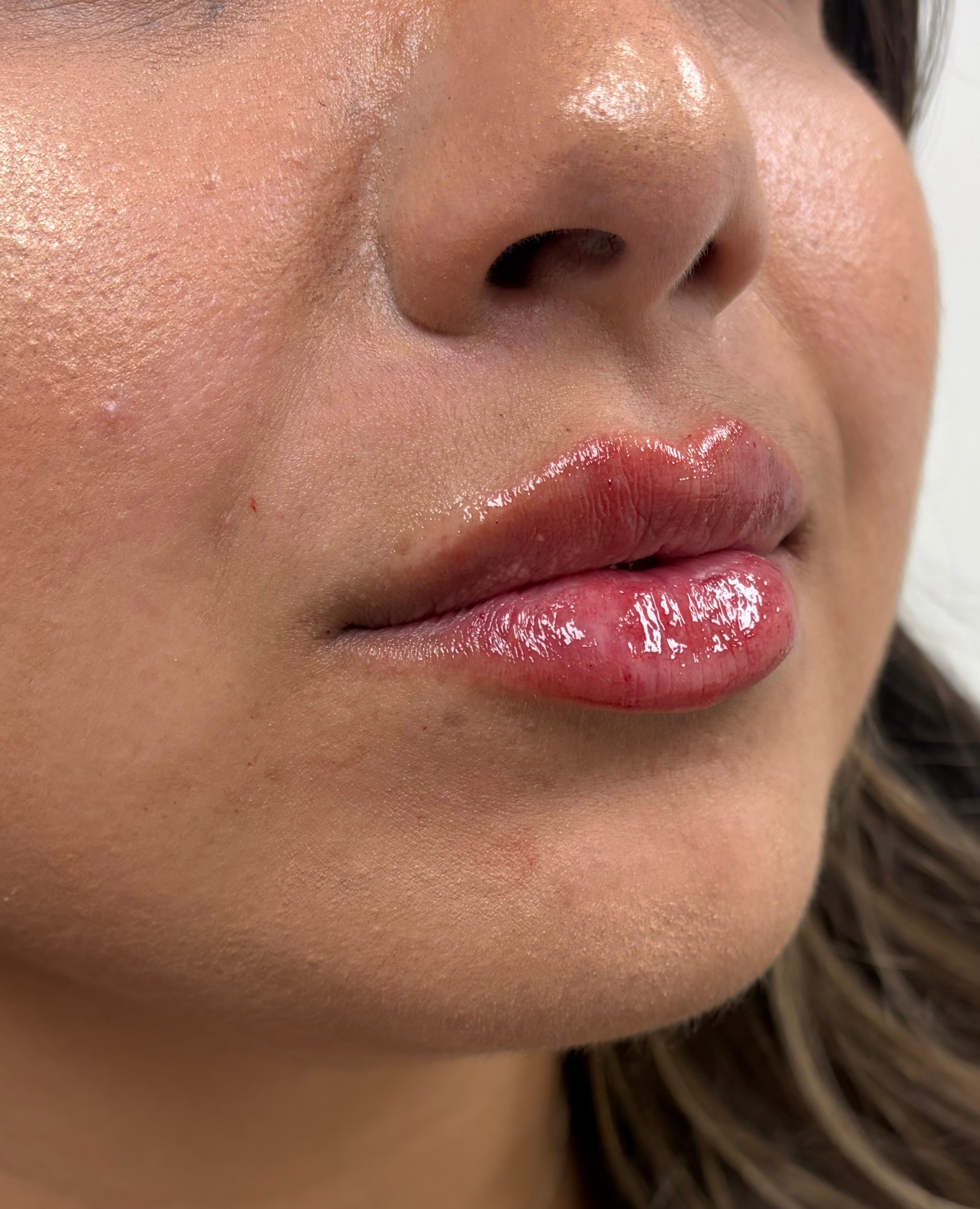 After treatment