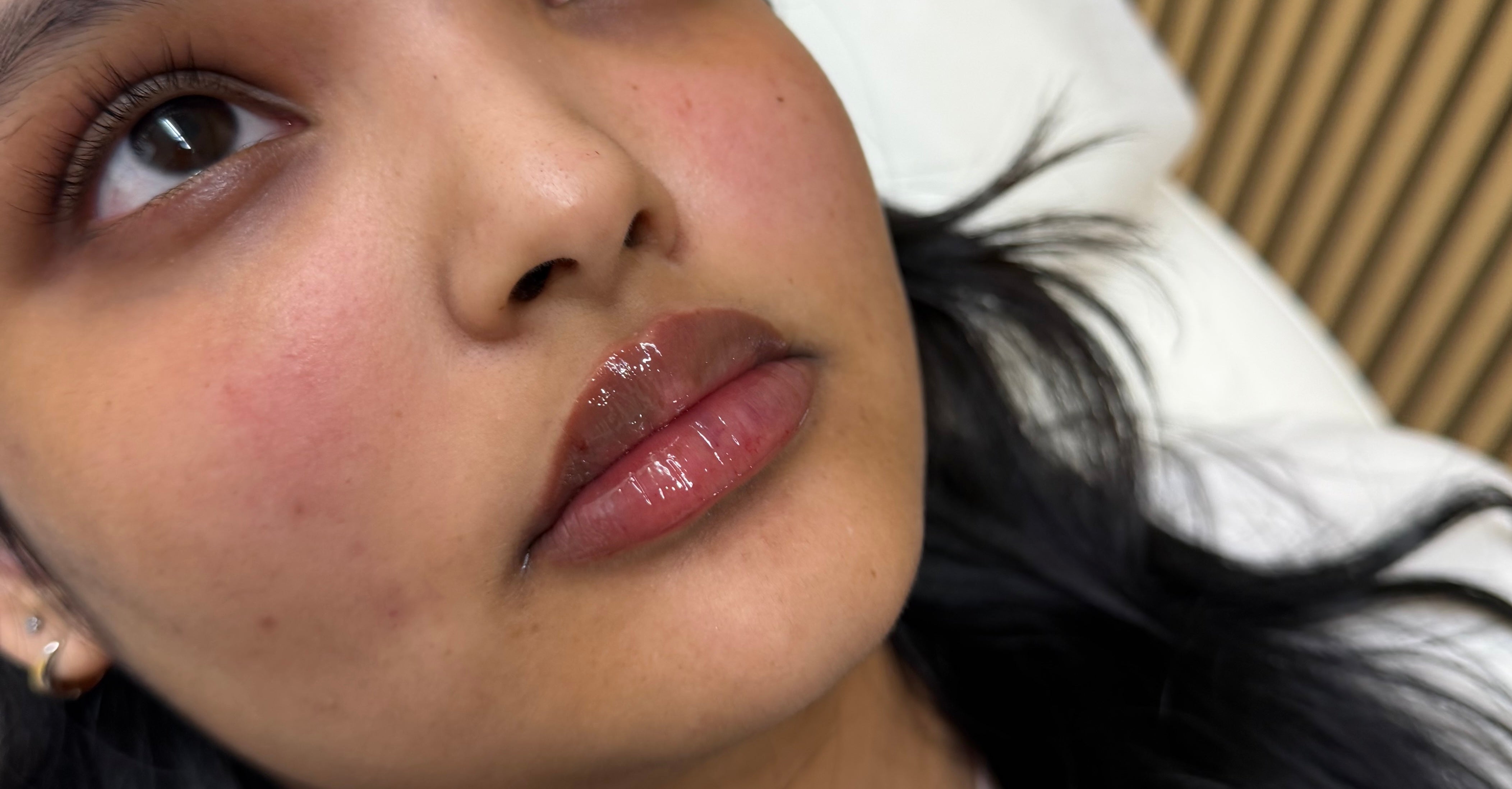 After treatment