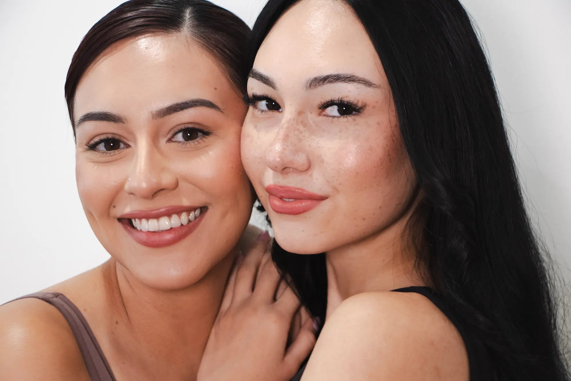 Restylane in Los Angeles Expert Care, Natural Results