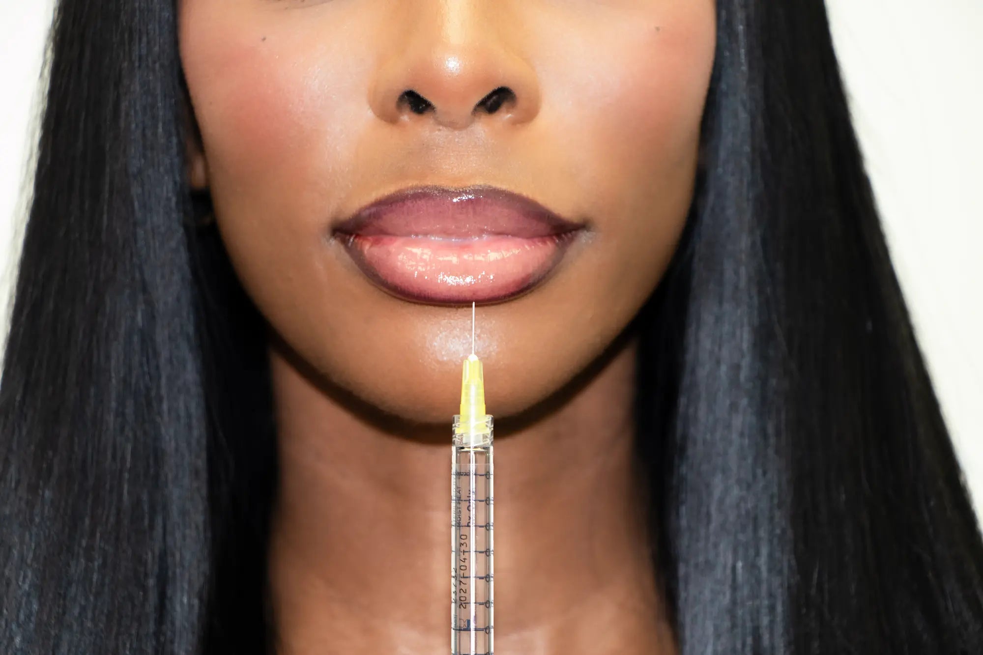 What Lip Filler Actually Does