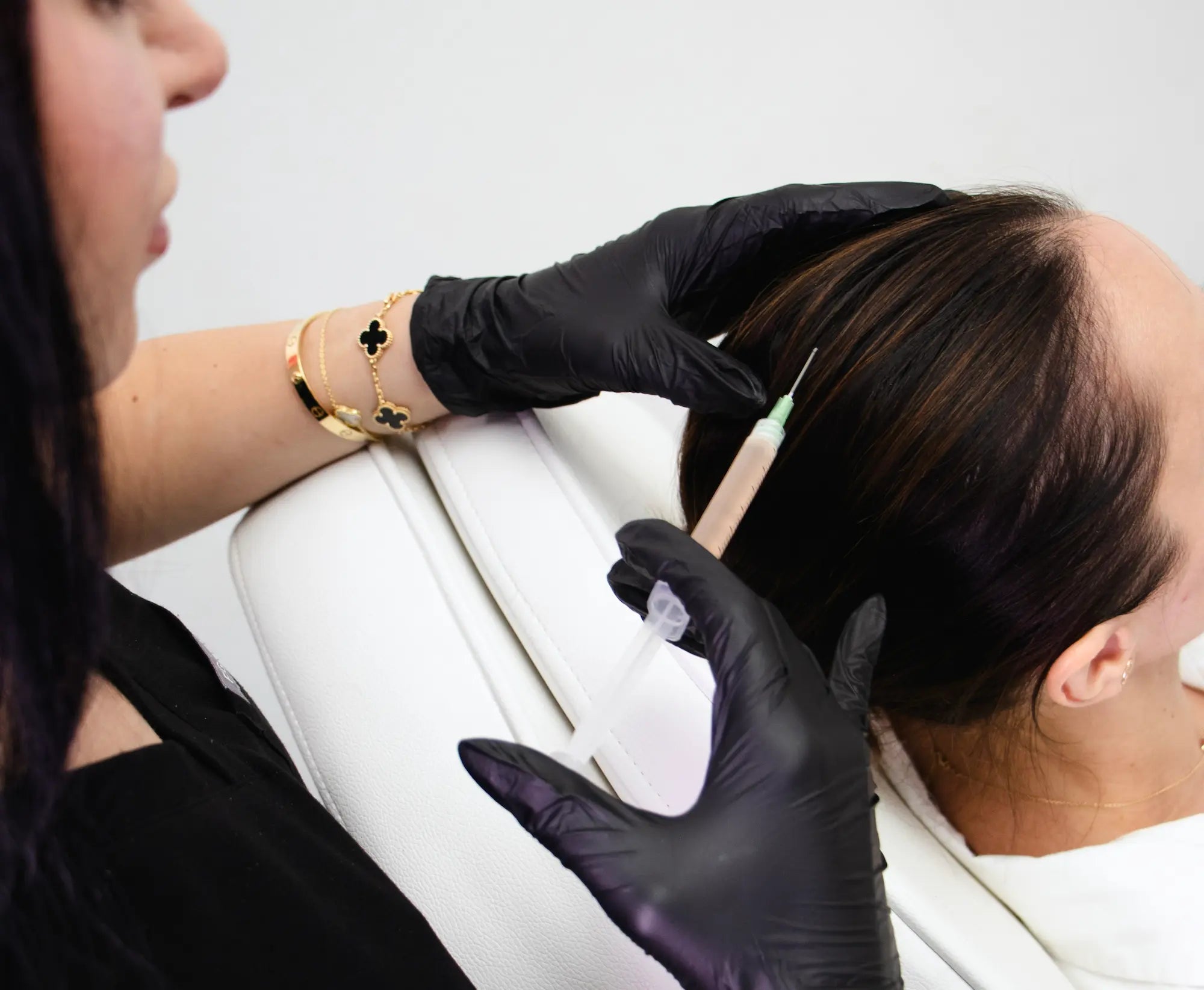 PRP in Los Angeles Expert Care, Natural Results