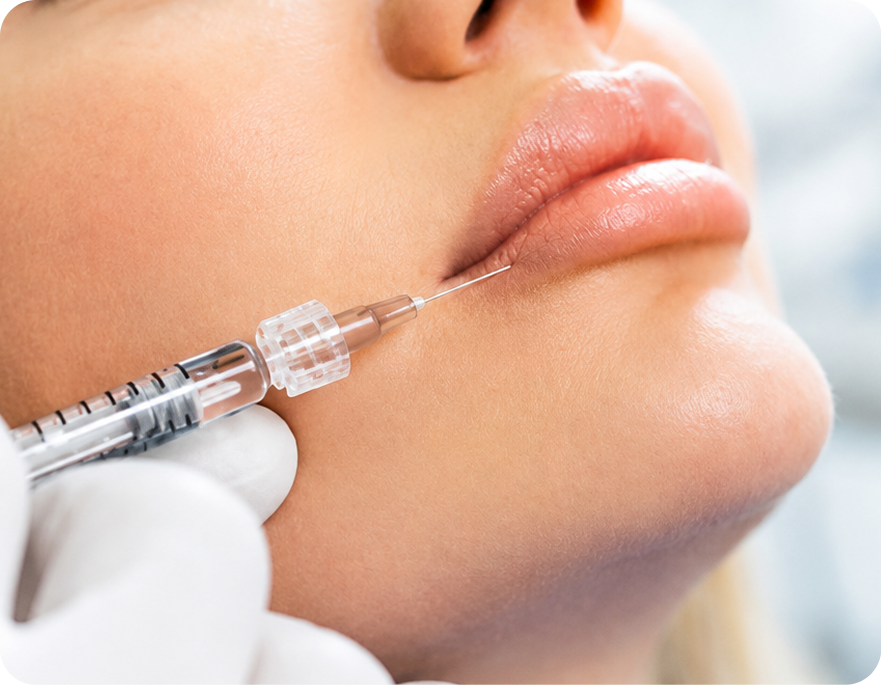 What Lip Filler Actually Does