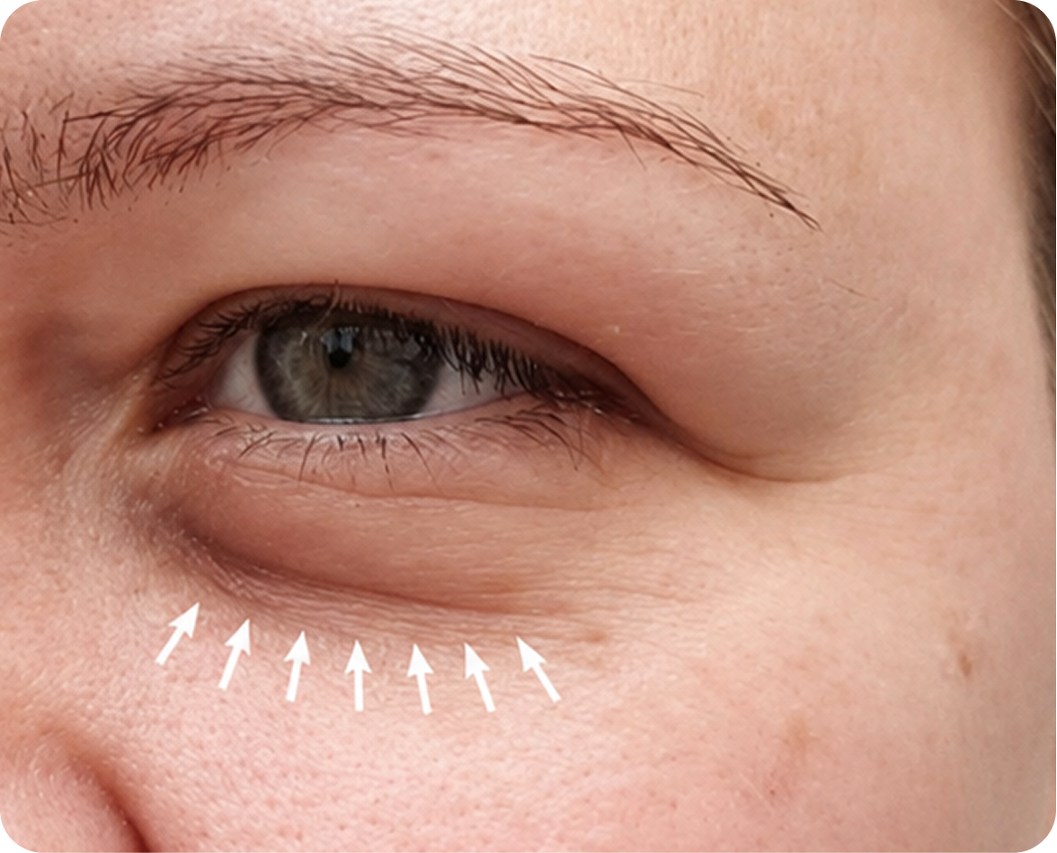 After treatment