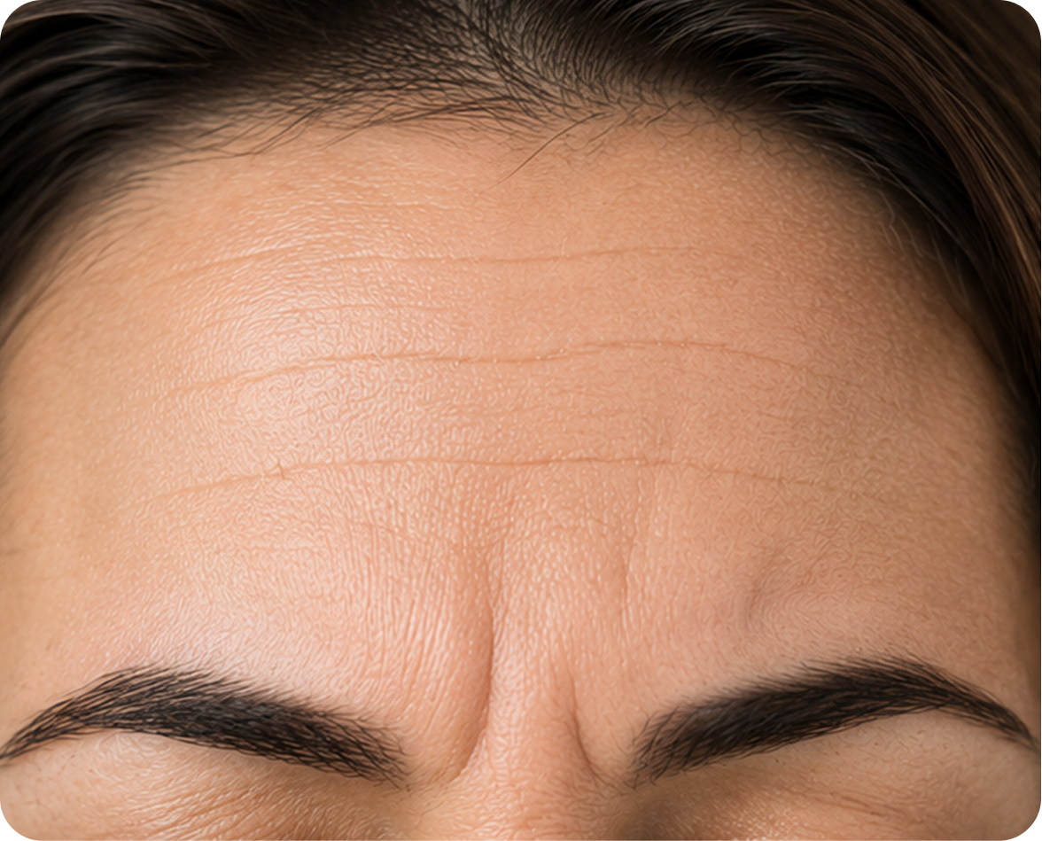Before treatment