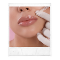 Load image into Gallery viewer, Lip Filler (your choice of: Juvederm ultra/ultra plus, Volbella, Vollure, Restylane Kysse, Restylane Refyne/Defyne, 1ml)
