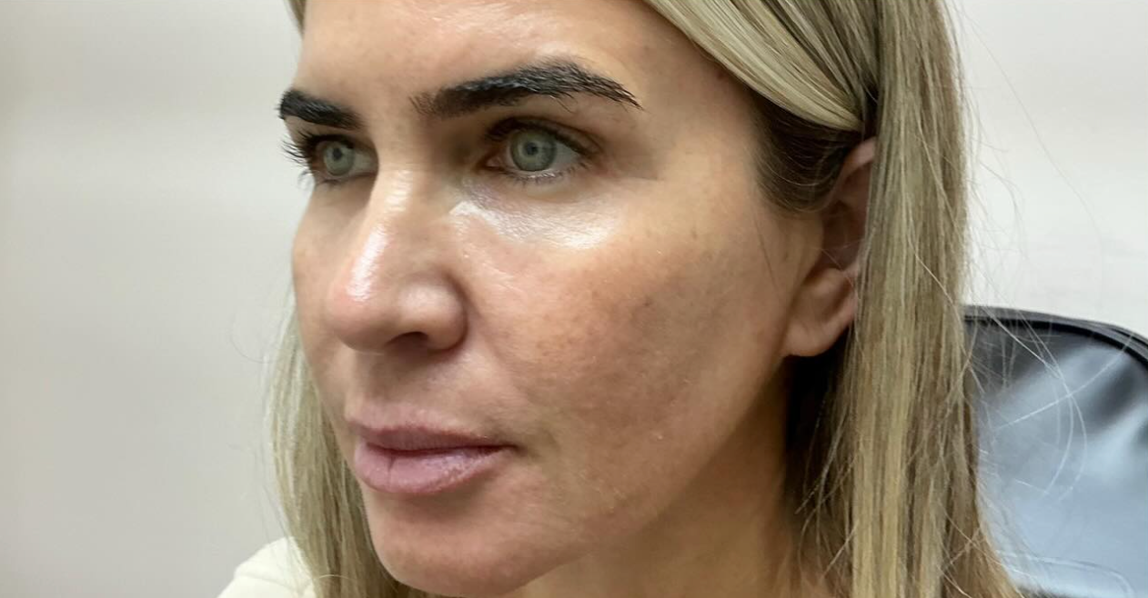 Before treatment