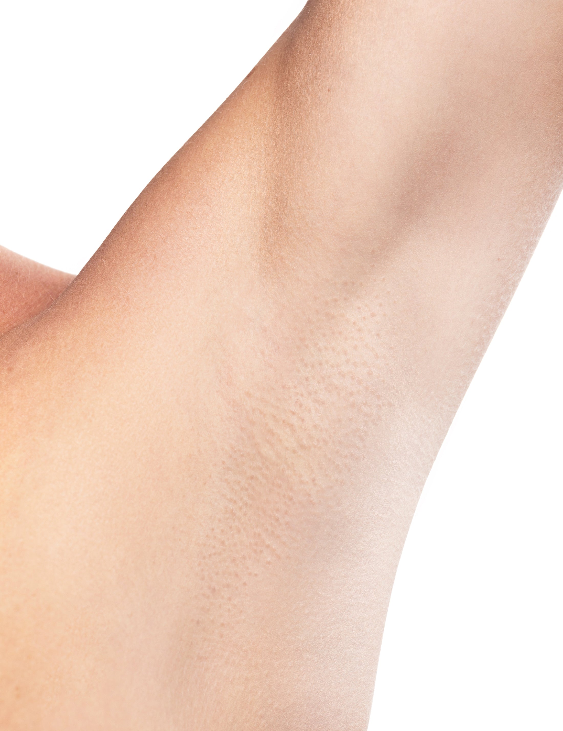 Laser Hair Removal for Women (Single Session)